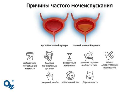 Боль в промежности и частое мочеиспускание при простатите