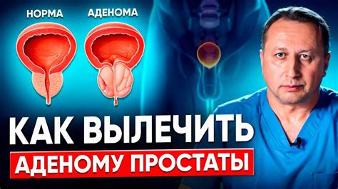 Симптомы простатита и признаки воспаления предстательной железы